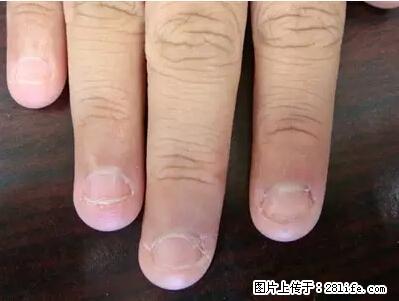 剪指甲、挖耳屎，这些日常小动作竟隐藏大危害！ - 哈尔滨生活资讯 - 哈尔滨28生活网 hrb.28life.net